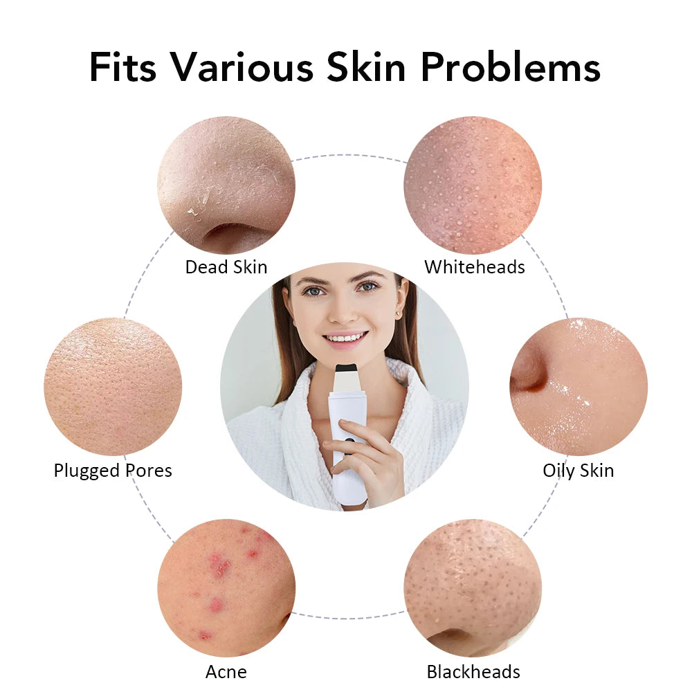 Ultrasonic Skin Scrubber - Deep Pore Facial Cleansing Device