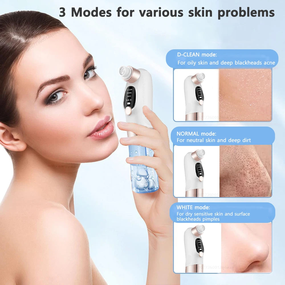 Electric Blackhead Remover Vacuum - Pore Face Cleaner